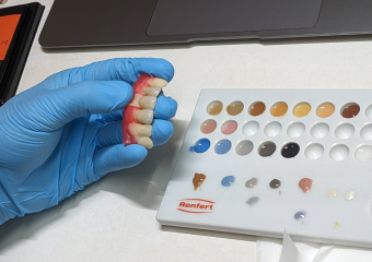 歯科技工士が歯の形や色を直接確認できるため、自然な歯の色と、噛み合わせに調和する技工物を作製することができます。